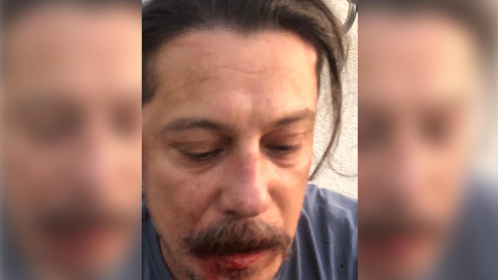 Journalisten besser schützen – auch in Europa