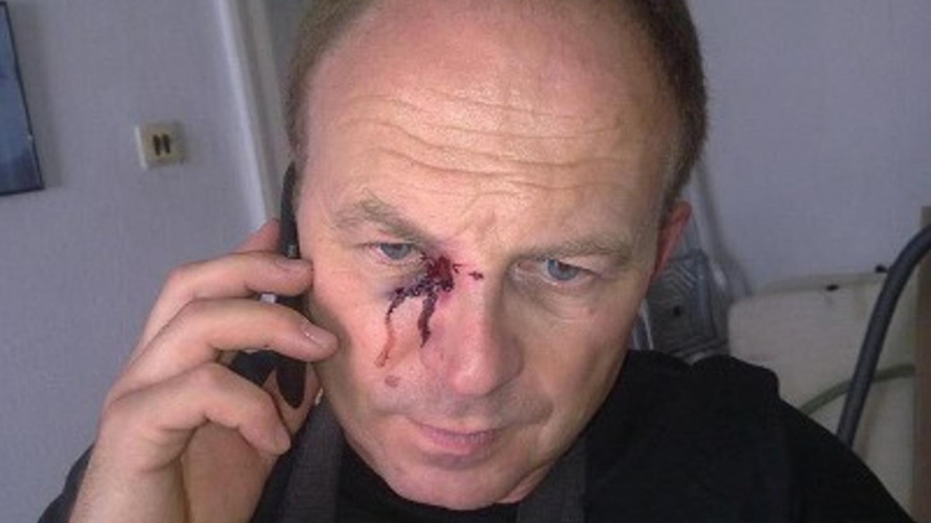 Journalisten dürfen nicht über Proteste der Opposition berichten