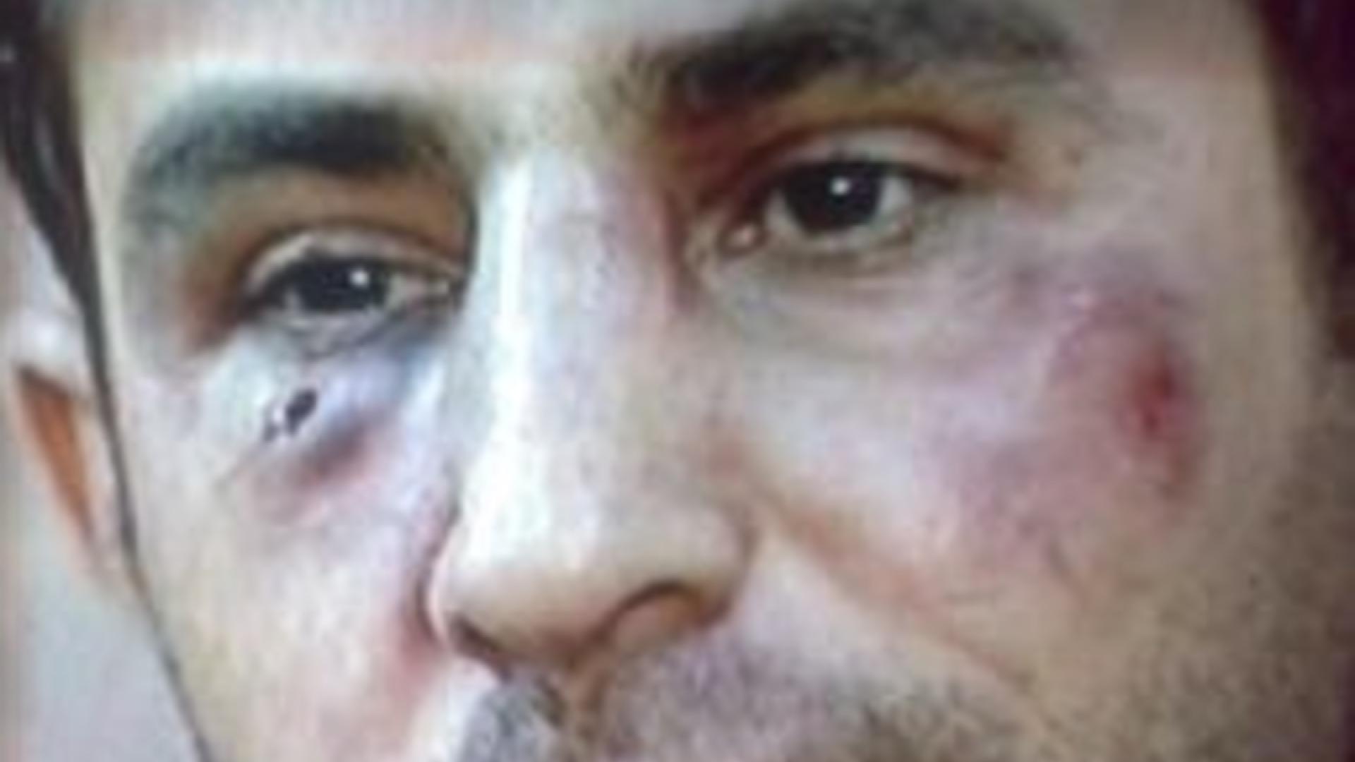 ROG fordert Aufklärung von Angriff auf kurdischen Journalisten